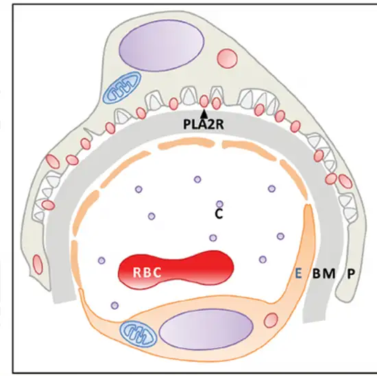 phospholipase a2 receptor antibody